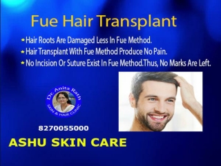 Ashu skin care best hair transplant clinic  in bhubaneswar odisha for acne scar treatment