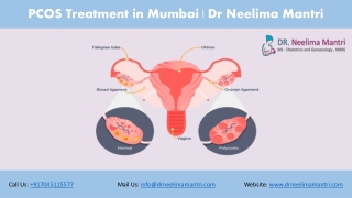 PCOS Treatment in Mumbai | Dr Neelima Mantri