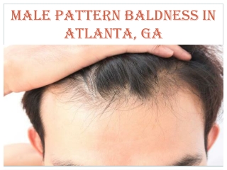 MALE PATTERN BALDNESS IN ATLANTA, GA