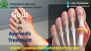 Gout Symptoms Causes and Natural Treatment.