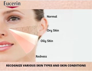 Identify Your Skin Types & Condition