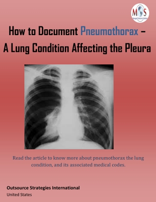 How to Document Pneumothorax – A Lung Condition Affecting the Pleura