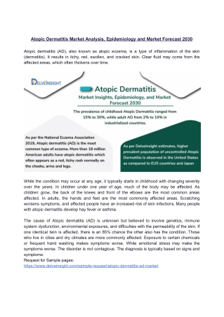 Atopic Dermatitis Market Analysis, Epidemiology and Market Forecast 2030