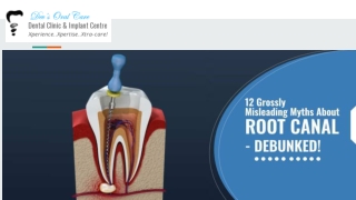 12 Grossing Misleading Myths About Root Canal - Debunked!