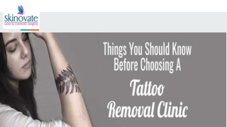 Things You Should Know Before Choosing A Tattoo Removal Clinic