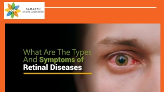 What are the types and symptoms of retinal diseases