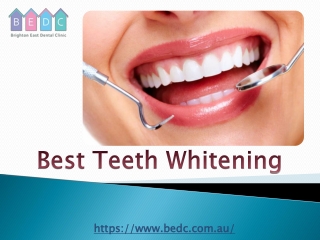 Best Teeth Whitening - (03-95788500) - BEDC