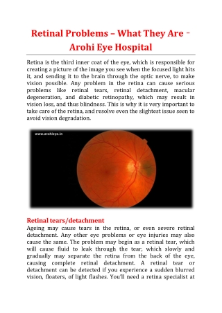 Retinal Problems – What They Are - Arohi Eye Hospital