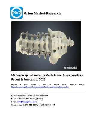 US Fusion Spinal Implants Market Size, Share and Forecast 2019-2025