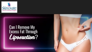 CAN I REMOVE MY EXCESS FAT THROUGH LIPOSUCTION?