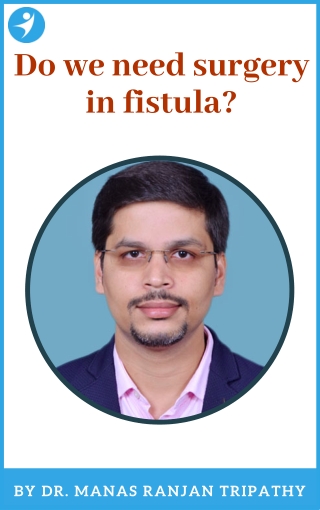 Do we need surgery in fistula? | Fistula Treatment in Bangalore, HSR Layout, Koramangala