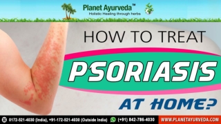 How to Treat Psoriasis at Home? - Ayurvedic Treatment