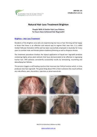 Natural Hair Loss Treatment Brighton | Men & Women Hair Regrowth Treatment