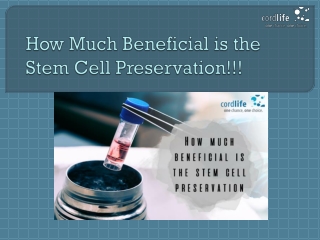How Much Beneficial is the Stem Cell Preservation!!!