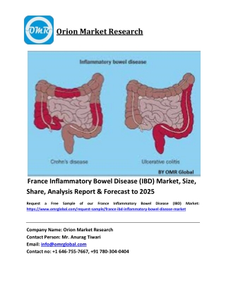France Inflammatory Bowel Disease (IBD) Market Market Size, Share and Forecast 2019-2025