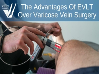 The Advantages Of EVLT Over Varicose Vein Surgery