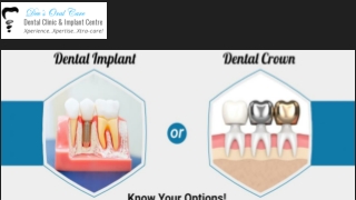 Dental Implant or Dental Crown - Know Your Options!