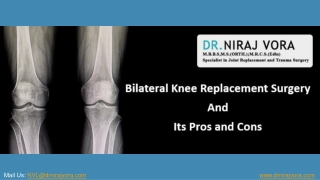 What Is Bilateral Knee Replacement Surgery? What Are Its Pros and Cons?