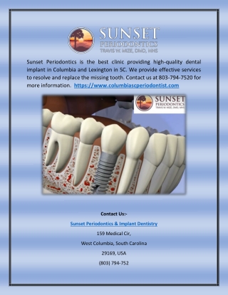 Dental Implant in Columbia, Lexington, SC (Sunset Periodontics & Implant Dentistry)