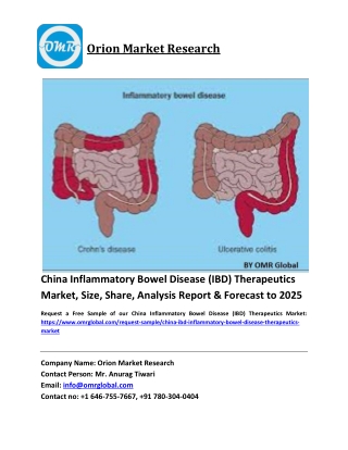 China Breast Cancer Therapeutics Market Growth, Size, Share, Industry Report and Forecast 2019-2025