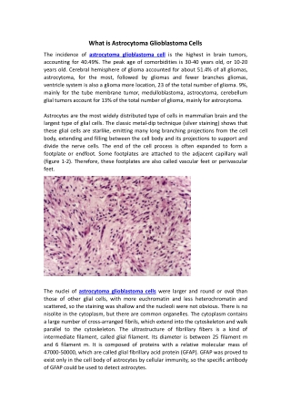 astrocytoma glioblastoma cells