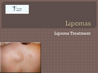 Find the Safe and Natural Lipoma Treatment
