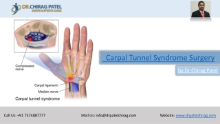 Carpal Tunnel Syndrome Surgery by Dr Chirag Patel