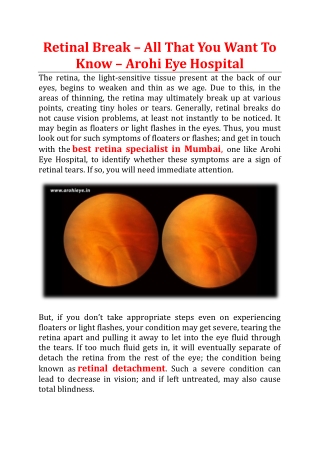 Retinal Break – All That You Want To Know - Arohi Eye Hospital