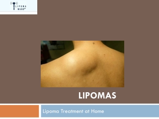Get a Secure Lipoma Removal at Home