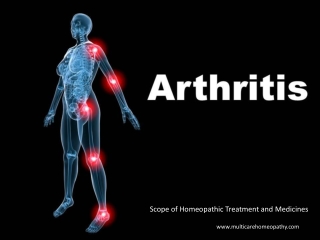 6 Best Homeopathic Medicines for ARTHRITIS,JOINTS PAIN Treatment