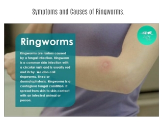 Symptoms and Causes of Ringworms.