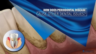 How does Periodontal Disease Cause Other Dental Issues