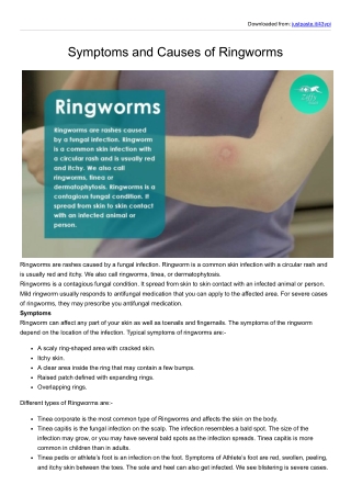 Symptoms and Causes of Ringworms