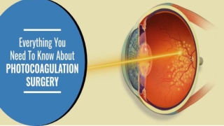 Everything You Need To Know About Photocoagulation Surgery