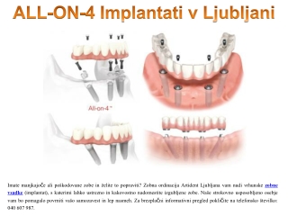 ALL-ON-4 implantati v Ljubljani