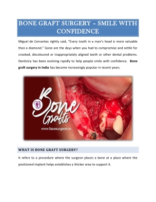 Bone graft surgery - Smile with confidence