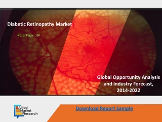 Diabetic Retinopathy Market Growth Prospects to 2026