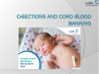 C-Sections and Cord Blood Banking: What You Need to Know
