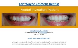 Fort Wayne Cosmetic Dentist