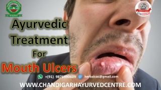 What is the Ayurvedic Treatment to Cure Mouth Ulcers?