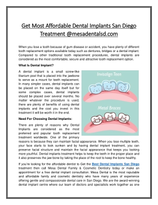 Get Most Affordable Dental Implants San Diego Treatment @mesadentalsd.com