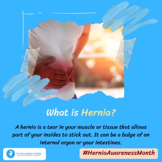 What is Hernia | Hernia Surgery in Bangalore, HSR Layout, Koramangala | Dr. Manas Tripathy