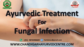 What is the Ayurvedic Treatment for Fungal Infection?