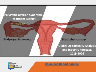 Polycystic Ovarian Syndrome Treatment Market Demands & Growth Analysis To 2026