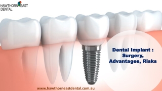 Dental Implant Surgery, Advantages, Risks