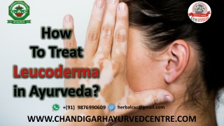 What is the Ayurvedic Treatment for Leucoderma?