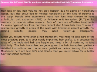 Post Hair Transplant Procedure