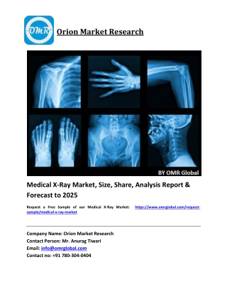 Medical X-Ray Market Growth, Size, Share, Industry Report and Forecast 2019-2025
