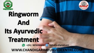 How to Cure Ringworm Naturally?