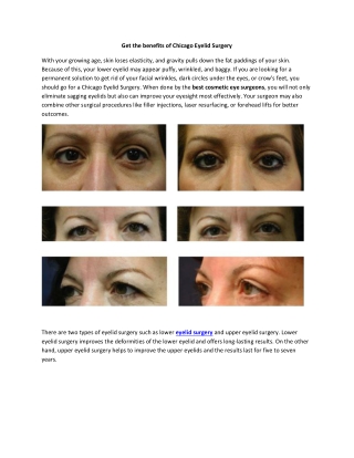 Get the benefits of Chicago Eyelid Surgery
